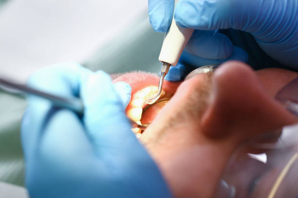Best Pediatric Emergency Dentist in Honesdale, PA